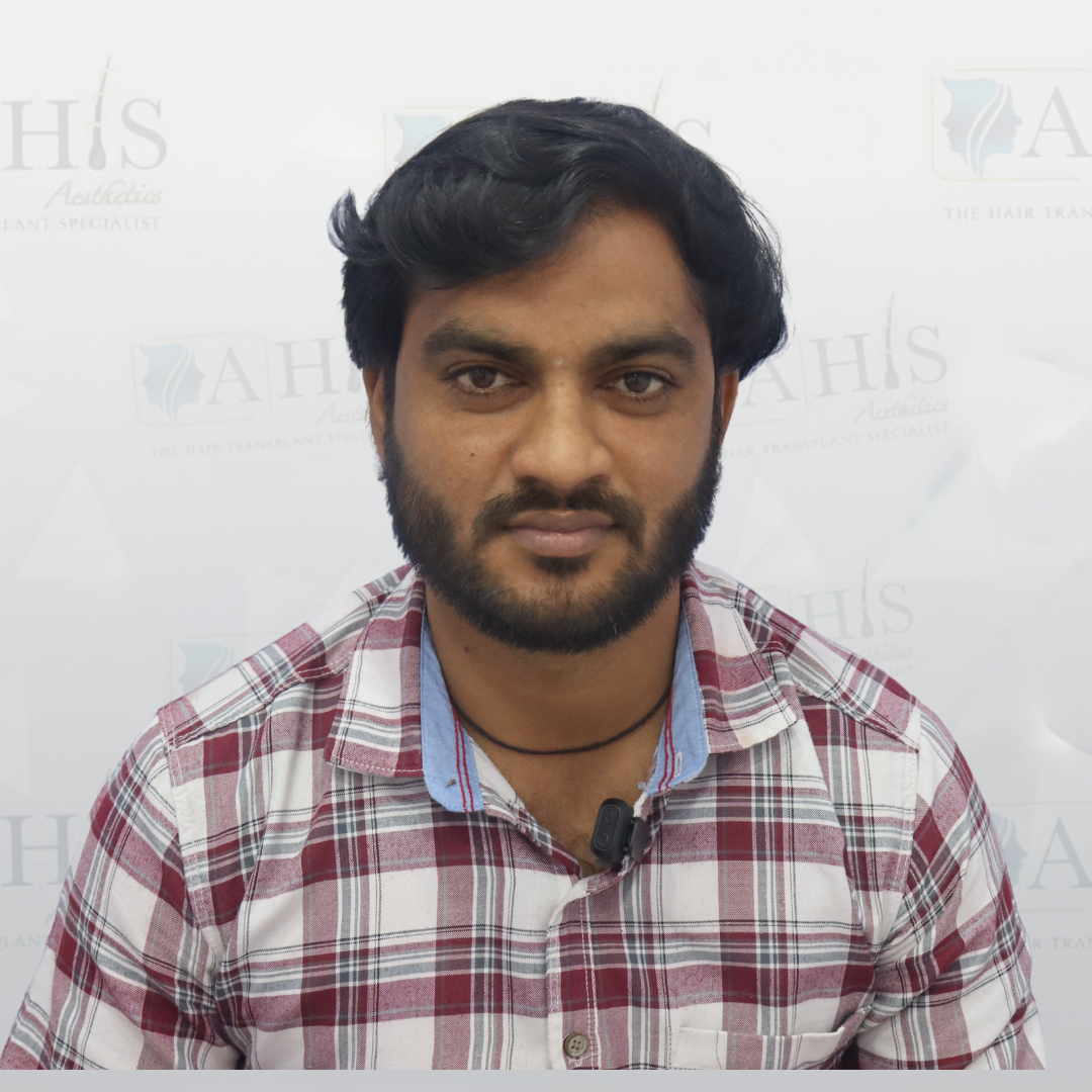 Hairline Reconstruction & Density — after hair transplant at AHIS Aesthetics Mysore
